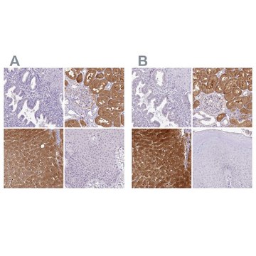 Anti-HPD antibody produced in rabbit Prestige Antibodies&#174; Powered by Atlas Antibodies, affinity isolated antibody, buffered aqueous glycerol solution