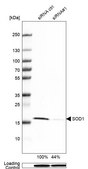 Anti-SOD1 antibody produced in rabbit Prestige Antibodies&#174; Powered by Atlas Antibodies, affinity isolated antibody, buffered aqueous glycerol solution