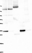 Anti-YIPF1 antibody produced in rabbit Prestige Antibodies&#174; Powered by Atlas Antibodies, affinity isolated antibody, buffered aqueous glycerol solution