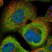 Anti-SAMD9 antibody produced in rabbit Prestige Antibodies&#174; Powered by Atlas Antibodies, affinity isolated antibody, buffered aqueous glycerol solution, Ab1