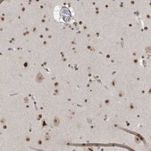 Anti-DDX42 antibody produced in rabbit affinity isolated antibody, buffered aqueous glycerol solution