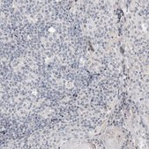 Anti-CRAT antibody produced in rabbit Prestige Antibodies&#174; Powered by Atlas Antibodies, affinity isolated antibody, buffered aqueous glycerol solution, Ab2
