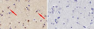 Anti-Cullin-1 Antibody, clone 1B14 ZooMAb&#174; Rabbit Monoclonal recombinant, expressed in HEK 293 cells