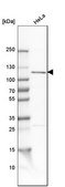 Anti-OGT antibody produced in rabbit Prestige Antibodies&#174; Powered by Atlas Antibodies, affinity isolated antibody, buffered aqueous glycerol solution, ab2