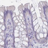 Anti-CYP51A1 antibody produced in rabbit Prestige Antibodies&#174; Powered by Atlas Antibodies, affinity isolated antibody, buffered aqueous glycerol solution