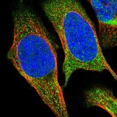 Anti-SESN2 antibody produced in rabbit Prestige Antibodies&#174; Powered by Atlas Antibodies, affinity isolated antibody, buffered aqueous glycerol solution