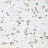 Anti-CHD1 antibody produced in rabbit