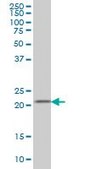 Monoclonal Anti-DHFR antibody produced in mouse clone 2B10, purified immunoglobulin, buffered aqueous solution