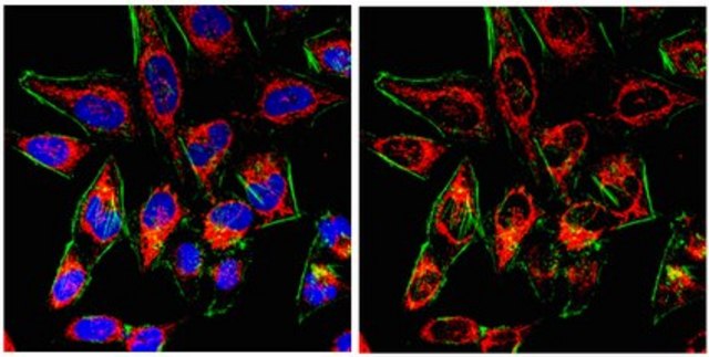 Anti-Probable ergosterol biosynthetic protein 28 Antibody from rabbit, purified by affinity chromatography