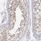 Anti-ESPN antibody produced in rabbit affinity isolated antibody, buffered aqueous glycerol solution