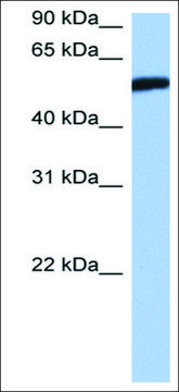 Anti-HMG20A (AB2) antibody produced in rabbit affinity isolated antibody