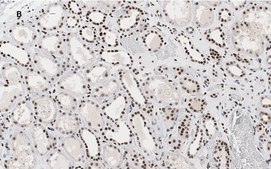 Anti-HMGB1 Antibody, clone 3K6, ZooMAb&#174; Rabbit Monoclonal recombinant, expressed in HEK 293 cells