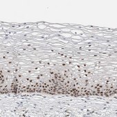 Anti-PUS7 antibody produced in rabbit Prestige Antibodies&#174; Powered by Atlas Antibodies, affinity isolated antibody, buffered aqueous glycerol solution