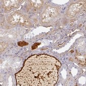 Anti-ALB antibody produced in rabbit Prestige Antibodies&#174; Powered by Atlas Antibodies, affinity isolated antibody, buffered aqueous glycerol solution