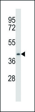 ANTI-DPAGT1 (N-TERM) antibody produced in rabbit IgG fraction of antiserum, buffered aqueous solution