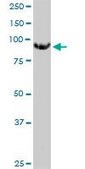 Monoclonal Anti-MGAT5 antibody produced in mouse clone 3E9, purified immunoglobulin, buffered aqueous solution