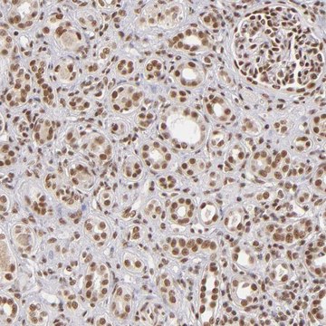 ANTI-ZNF148 antibody produced in rabbit Prestige Antibodies&#174; Powered by Atlas Antibodies, affinity isolated antibody, buffered aqueous glycerol solution