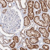 Anti-GLS antibody produced in rabbit Prestige Antibodies&#174; Powered by Atlas Antibodies, affinity isolated antibody, buffered aqueous glycerol solution