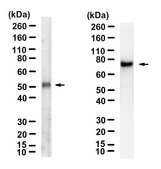 Anti-PNPLA3 Antibody, clone 11C5 ZooMAb&#174; Mouse Monoclonal recombinant, expressed in HEK 293 cells