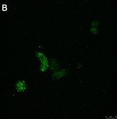 Anti-ATG8 Antibody, clone 2B11 ZooMAb&#174; Rabbit Monoclonal recombinant, expressed in HEK 293 cells