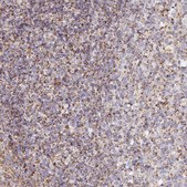 Anti-DONSON antibody produced in rabbit Prestige Antibodies&#174; Powered by Atlas Antibodies, affinity isolated antibody, buffered aqueous glycerol solution