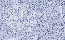 Anti-Helicase MOV-10 Antibody, clone 3B8 ZooMAb&#174; Rabbit Monoclonal recombinant, expressed in HEK 293 cells