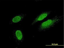 Monoclonal Anti-TTN antibody produced in mouse clone 6H5, purified immunoglobulin, buffered aqueous solution
