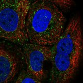 Anti-TRIM17 antibody produced in rabbit Prestige Antibodies&#174; Powered by Atlas Antibodies, affinity isolated antibody, buffered aqueous glycerol solution