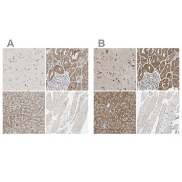 Anti-LHPP antibody produced in rabbit Prestige Antibodies&#174; Powered by Atlas Antibodies, affinity isolated antibody, buffered aqueous glycerol solution