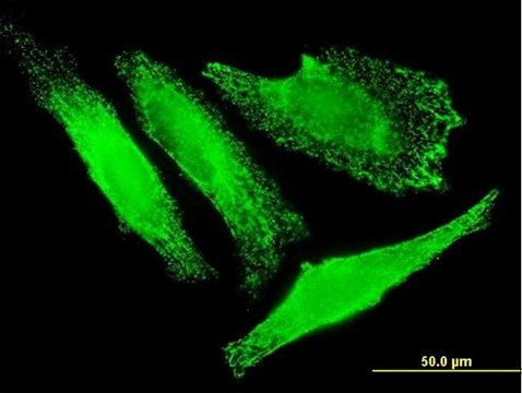 Monoclonal Anti-SLC25A20 antibody produced in mouse clone M2, purified immunoglobulin, buffered aqueous solution