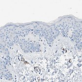 Anti-DYSF antibody produced in rabbit Prestige Antibodies&#174; Powered by Atlas Antibodies, affinity isolated antibody, buffered aqueous glycerol solution