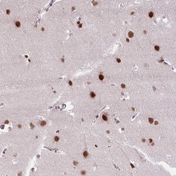 Anti-ZNF672 antibody produced in rabbit Prestige Antibodies&#174; Powered by Atlas Antibodies, affinity isolated antibody, buffered aqueous glycerol solution