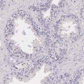 Anti-MYH6 antibody produced in rabbit Prestige Antibodies&#174; Powered by Atlas Antibodies, affinity isolated antibody, buffered aqueous glycerol solution