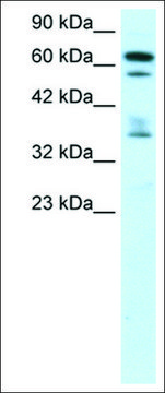 Anti-ZNF512 antibody produced in rabbit affinity isolated antibody