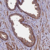 Anti-DNM1L antibody produced in rabbit Prestige Antibodies&#174; Powered by Atlas Antibodies, affinity isolated antibody, buffered aqueous glycerol solution