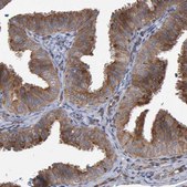 Anti-LRBA antibody produced in rabbit Prestige Antibodies&#174; Powered by Atlas Antibodies, affinity isolated antibody, buffered aqueous glycerol solution, Ab2