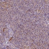 Anti-WARS2 antibody produced in rabbit Prestige Antibodies&#174; Powered by Atlas Antibodies, affinity isolated antibody