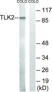 Anti-TLK2 antibody produced in rabbit affinity isolated antibody