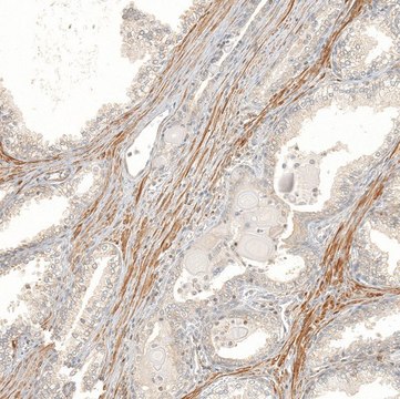 Anti-FBXO42 antibody produced in rabbit Prestige Antibodies&#174; Powered by Atlas Antibodies, affinity isolated antibody, buffered aqueous glycerol solution