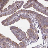 Anti-CSF3R antibody produced in rabbit Prestige Antibodies&#174; Powered by Atlas Antibodies, affinity isolated antibody, buffered aqueous glycerol solution