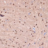 Anti-Carbonic Anhydrase 1 (CA2) antibody produced in rabbit