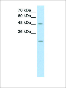 Anti-ANKRD2 antibody produced in rabbit affinity isolated antibody