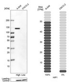 Anti-HIP1 antibody produced in rabbit Prestige Antibodies&#174; Powered by Atlas Antibodies, affinity isolated antibody, buffered aqueous glycerol solution