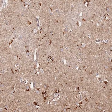 Anti-RIMBP2 antibody produced in rabbit Prestige Antibodies&#174; Powered by Atlas Antibodies, affinity isolated antibody, buffered aqueous glycerol solution