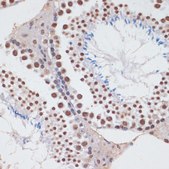 Anti-PCNA antibody produced in rabbit