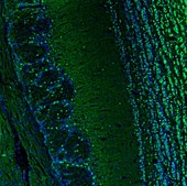Anti-BCL11B antibody produced in rabbit Prestige Antibodies&#174; Powered by Atlas Antibodies, affinity isolated antibody, buffered aqueous glycerol solution