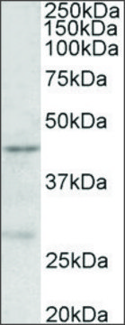 Anti-PRMT6 antibody produced in goat affinity isolated antibody, buffered aqueous solution