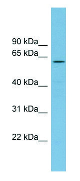 Anti-RIOK2 antibody produced in rabbit affinity isolated antibody