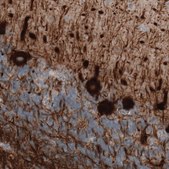 Monoclonal Anti-NEFM antibody produced in mouse Prestige Antibodies&#174; Powered by Atlas Antibodies, clone CL2705, purified immunoglobulin, buffered aqueous glycerol solution