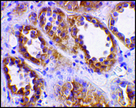 Anti-ACE2 antibody produced in rabbit affinity isolated antibody